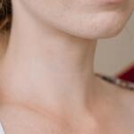 Face &amp; Neck Surgery Support