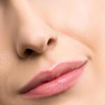 Rhinoplasty Support   (1st surgery)