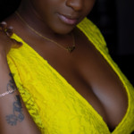 Breast Augmentation